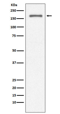 Anti-CD11a ITGAL Rabbit Monoclonal Antibody Boster Bio
