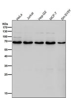 Anti-DLAT Rabbit Monoclonal Antibody Boster Bio