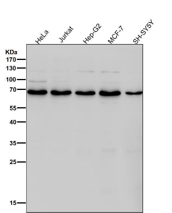 Anti-DLAT Rabbit Monoclonal Antibody Boster Bio