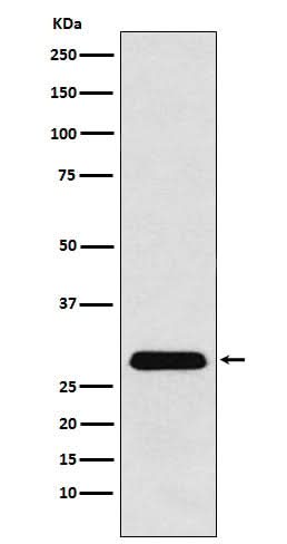 Anti-PGAM1 Rabbit Monoclonal Antibody Boster Bio