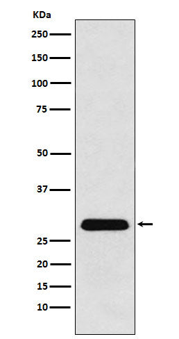 Anti-PGAM1 Rabbit Monoclonal Antibody Boster Bio