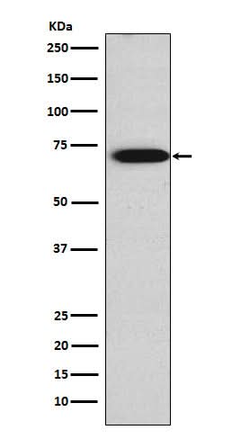 Anti-TRIM29 Rabbit Monoclonal Antibody Boster Bio