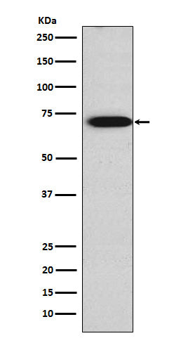 Anti-TRIM29 Rabbit Monoclonal Antibody Boster Bio