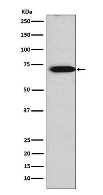 Anti-TRIM29 Rabbit Monoclonal Antibody Boster Bio