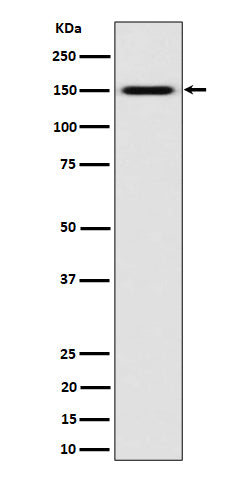 Anti-SLC12A1 / NKCC2 Rabbit Monoclonal Antibody Boster Bio