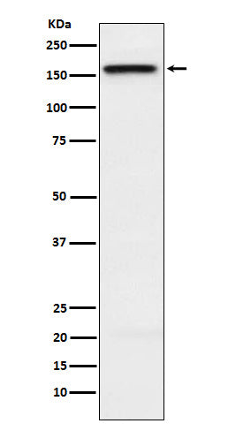 Anti-KIF4A Rabbit Monoclonal Antibody Boster Bio