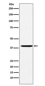 Anti-CAPG Rabbit Monoclonal Antibody Boster Bio