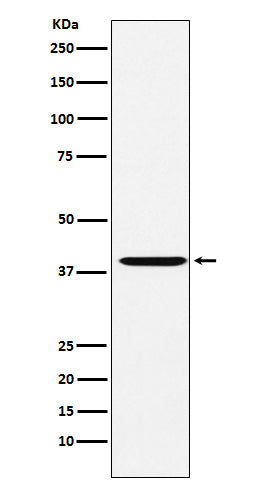 Anti-CAPG Rabbit Monoclonal Antibody Boster Bio