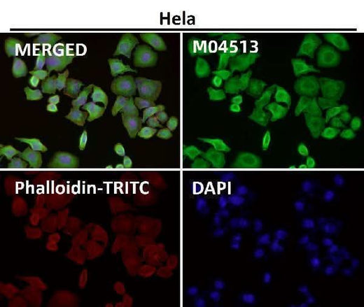 Anti-Lunatic Fringe Rabbit Monoclonal Antibody Boster Bio