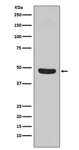 Anti-Flotillin 1 FLOT1 Rabbit Monoclonal Antibody Boster Bio