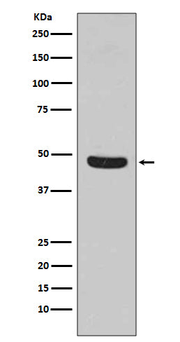 Anti-Flotillin 1 FLOT1 Rabbit Monoclonal Antibody Boster Bio
