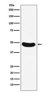 Anti-HB9/HLXB9 Monoclonal Antibody Boster Bio