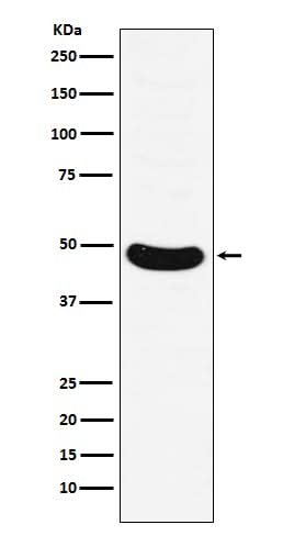 Anti-HB9/HLXB9 Monoclonal Antibody Boster Bio