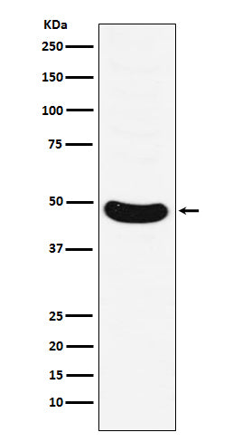 Anti-HB9/HLXB9 Monoclonal Antibody Boster Bio