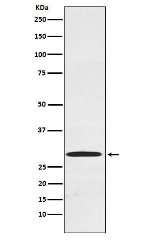 Anti-Cdx1 Rabbit Monoclonal Antibody Boster Bio
