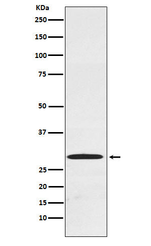 Anti-Cdx1 Rabbit Monoclonal Antibody Boster Bio