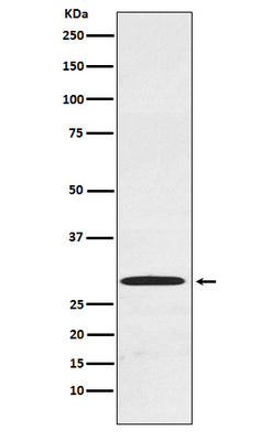 Anti-Cdx1 Rabbit Monoclonal Antibody Boster Bio