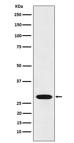 Anti-RCHY1 Rabbit Monoclonal Antibody Boster Bio