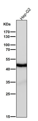 Anti-Cyclin E2 CCNE2 Rabbit Monoclonal Antibody Boster Bio