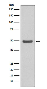 Anti-Cyclin E2 CCNE2 Rabbit Monoclonal Antibody Boster Bio