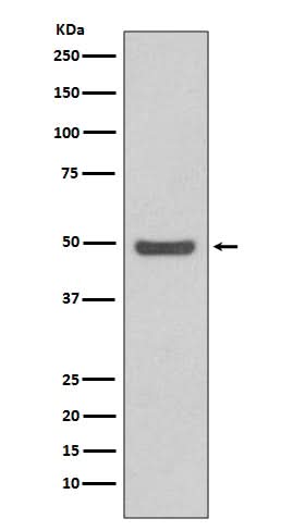 Anti-Cyclin E2 CCNE2 Rabbit Monoclonal Antibody Boster Bio