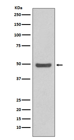 Anti-Cyclin E2 CCNE2 Rabbit Monoclonal Antibody Boster Bio