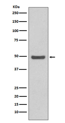 Anti-Cyclin E2 CCNE2 Rabbit Monoclonal Antibody Boster Bio
