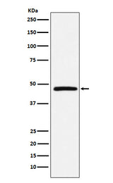 Anti-DARC Rabbit Monoclonal Antibody Boster Bio