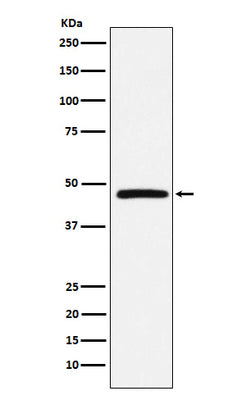 Anti-DARC Rabbit Monoclonal Antibody Boster Bio