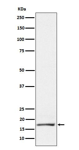 Anti-GCDFP 15 Rabbit Monoclonal Antibody Boster Bio