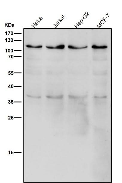 Anti-USP5 Rabbit Monoclonal Antibody Boster Bio