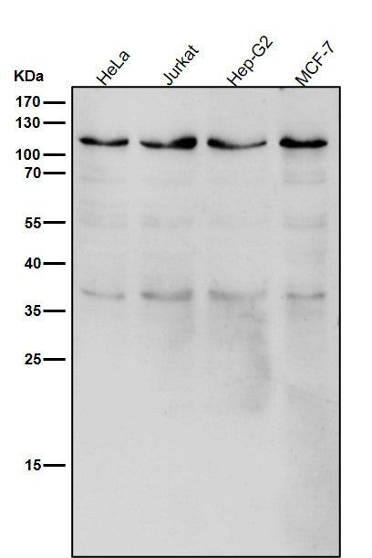 Anti-USP5 Rabbit Monoclonal Antibody Boster Bio