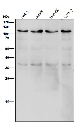 Anti-USP5 Rabbit Monoclonal Antibody Boster Bio