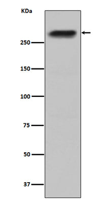 Anti-CENPE Monoclonal Antibody Boster Bio