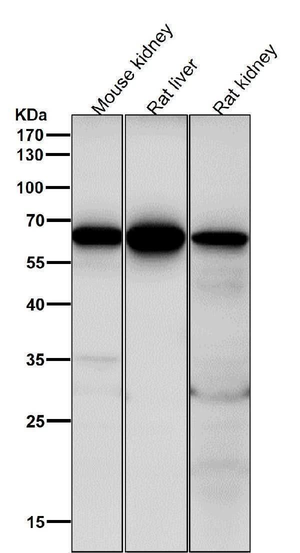Anti-Cdc16/APC6 Rabbit Monoclonal Antibody Boster Bio
