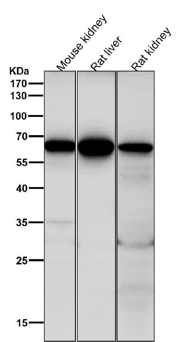 Anti-Cdc16/APC6 Rabbit Monoclonal Antibody Boster Bio