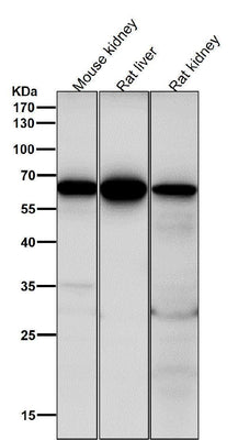 Anti-Cdc16/APC6 Rabbit Monoclonal Antibody Boster Bio