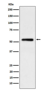 Anti-Human IgG1 Rabbit Monoclonal Antibody Boster Bio