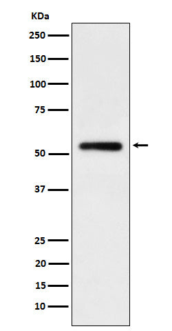 Anti-Human IgG1 Rabbit Monoclonal Antibody Boster Bio