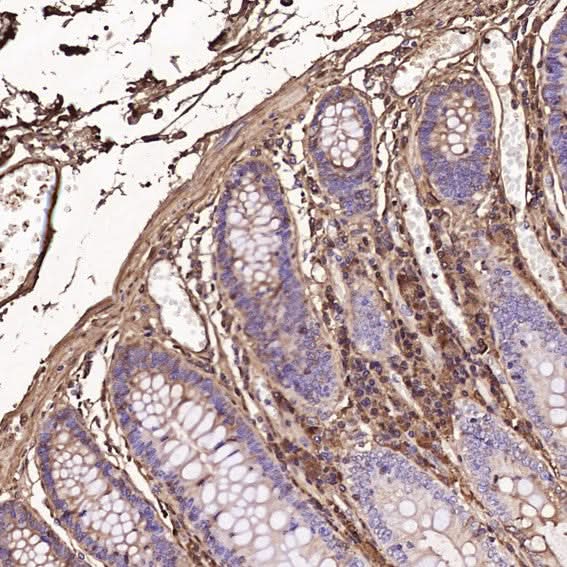 Anti-Human IgG IGHG1 Rabbit Monoclonal Antibody Boster Bio