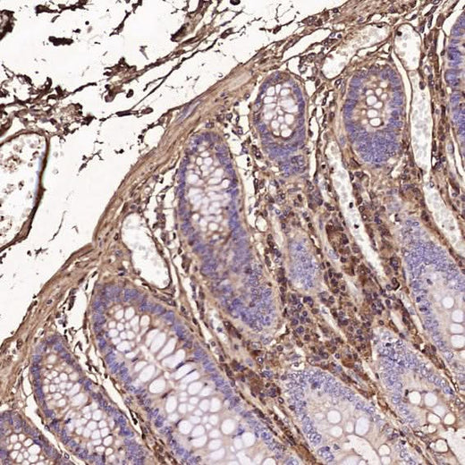 Anti-Human IgG IGHG1 Rabbit Monoclonal Antibody Boster Bio