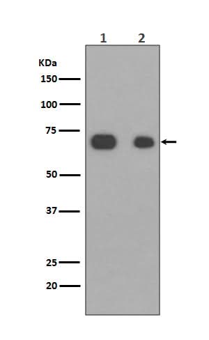 Anti-Caldesmon CALD1 Rabbit Monoclonal Antibody Boster Bio