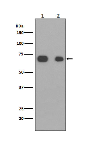 Anti-Caldesmon CALD1 Rabbit Monoclonal Antibody Boster Bio