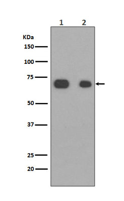 Anti-Caldesmon CALD1 Rabbit Monoclonal Antibody Boster Bio