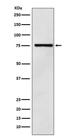 Anti-DCP1A Monoclonal Antibody Boster Bio