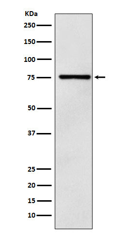 Anti-DCP1A Monoclonal Antibody Boster Bio