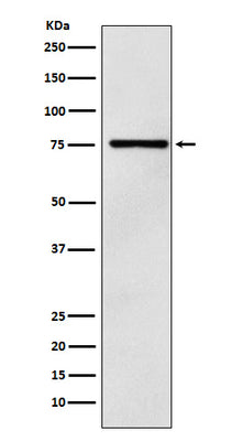 Anti-DCP1A Monoclonal Antibody Boster Bio
