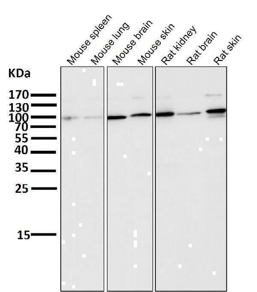 Anti-ALDH1L1 Rabbit Monoclonal Antibody Boster Bio