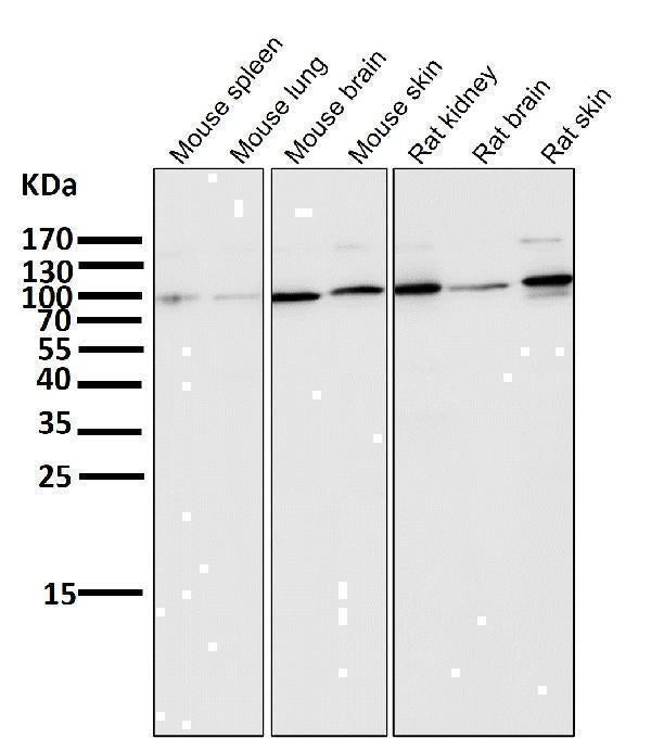 Anti-ALDH1L1 Rabbit Monoclonal Antibody Boster Bio