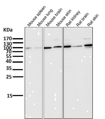 Anti-ALDH1L1 Rabbit Monoclonal Antibody Boster Bio